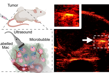 Researchers Use Air-Tagged Macrophages to Transform Cancer Imaging, Diagnosis, and Treatment