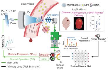 AI-Powered Ultrasound Research Expands Possibilities for Treating and Monitoring Brain Disease