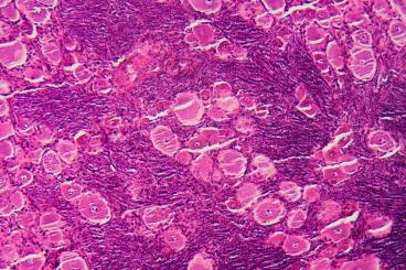 Organoids